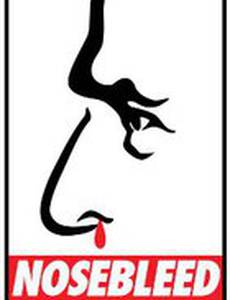 Nosebleed