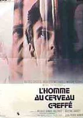 Человек с пересаженным мозгом