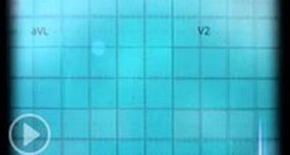 ТВ-ролик (61-я серия)