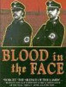 Кровь на лице