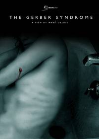 Постер Синдром Гербера