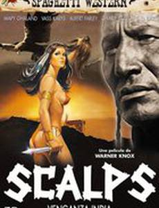 Скальпы