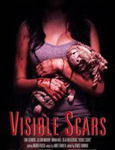 Видимые шрамы