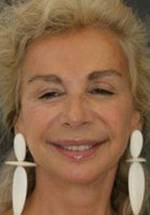 Франческа Ло Скьяво фото