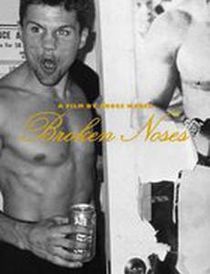 Сломанные носы