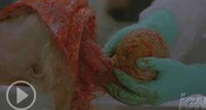 Тизер №2 («Вскрытие») - R-рейтинг