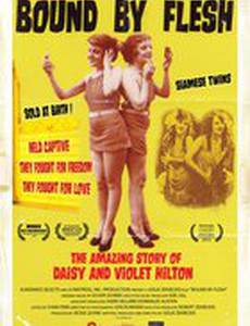 Сиамские близнецы