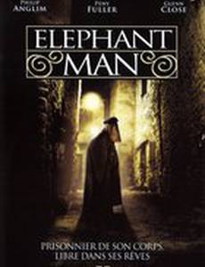 Человек-слон