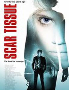 Рубцовая ткань