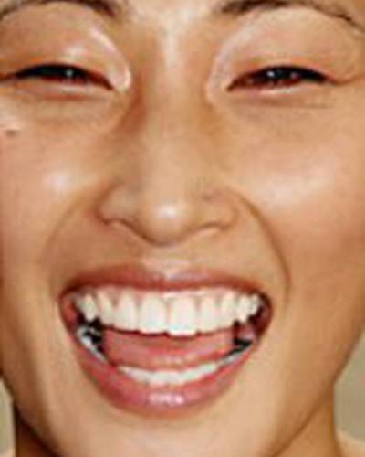 Эдди Юнгми фото