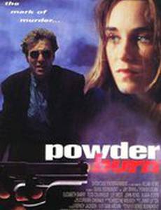 Пороховой ожог