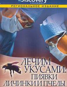 Discovery: Лечим укусами. Пиявки, личинки и пчелы