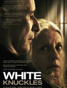 Белые суставы