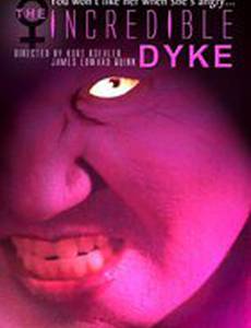 The Incredible Dyke