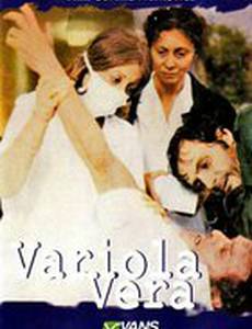 Натуральная оспа